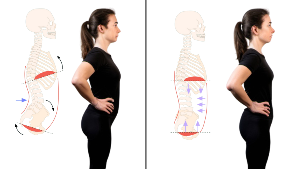 how to fix anterior pelvic tilt