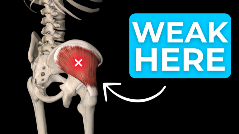 Glute medius weak pain